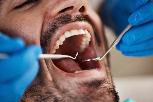 Best Emergency Denture Repair in Temple, TX